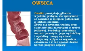 Owsiki a przedszkole: najważniejsze zasady postępowania dla rodziców