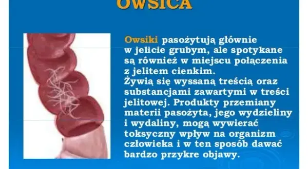 Owsiki a przedszkole: najważniejsze zasady postępowania dla rodziców